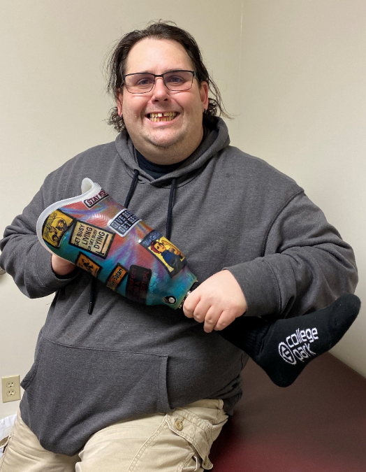 Patient Requests Patches as Artwork on His Prosthetic Socket!