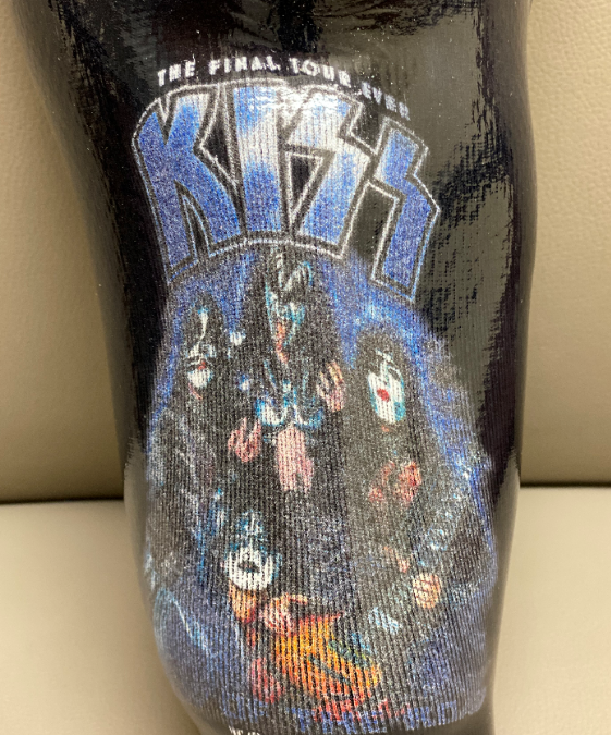 Patient is Thrilled with KISS Socket Artwork!