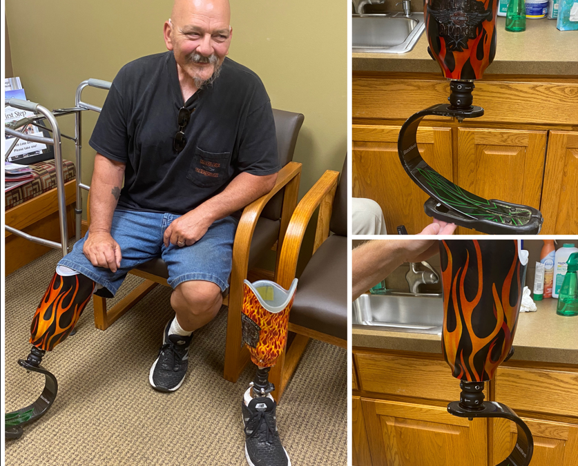Patient Thrilled With Custom Lamination with Flames!